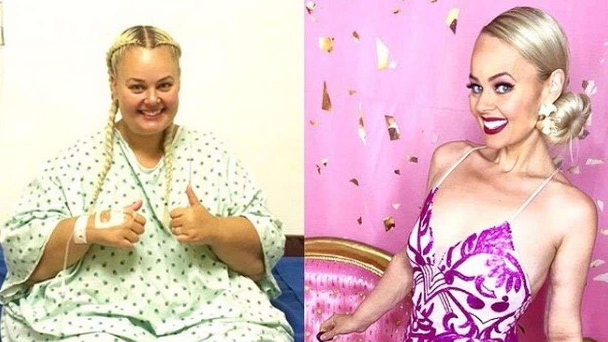 Một người phụ nữ ở Úc giảm hơn 90kg để đạt được ước mơ trở thành 'búp bê Barbie' đến suốt đời