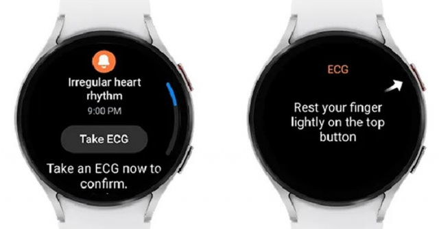 Samsung Galaxy Watch sắp có tính năng đáng giá cho người có vấn đề về tim mạch