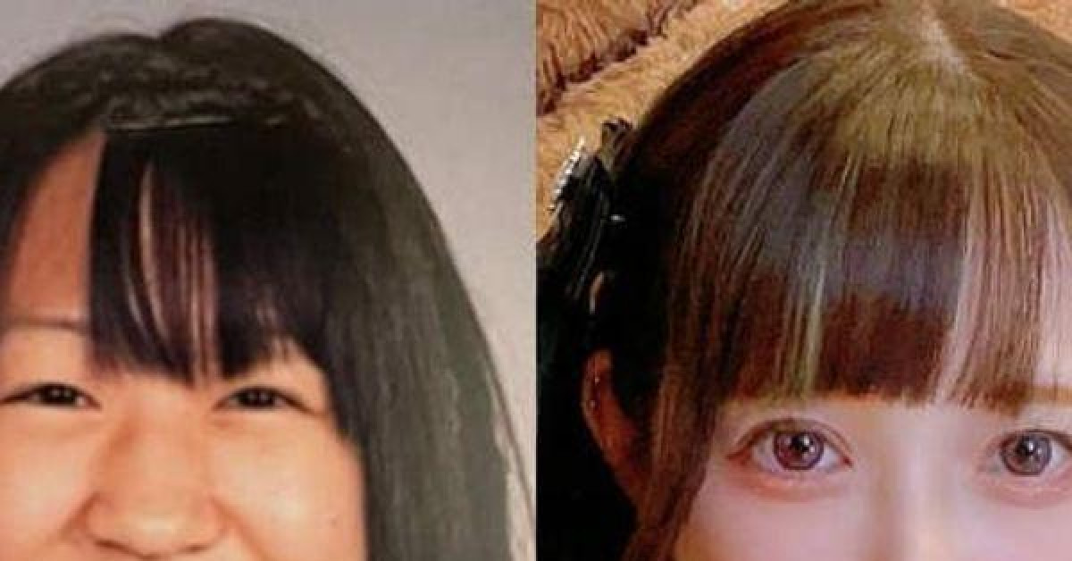Tiết lộ đụng dao kéo từ năm lớp 5, cô gái Nhật Bản gây tranh cãi