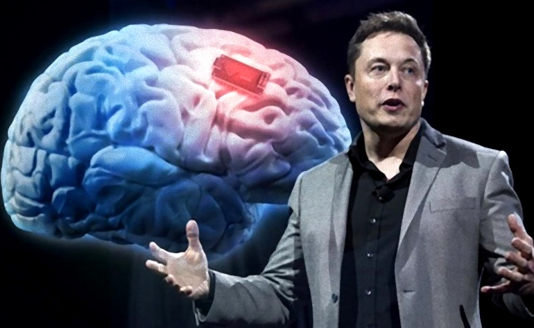 Vị tỷ phú Elon Musk đang lên kế hoạch thử nghiệm cấy chip vào não người