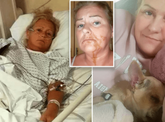 Bị cún cưng phóng uế vào miệng khi đang ngủ, người phụ nữ 51 tuổi phải nhập viện cấp cứu