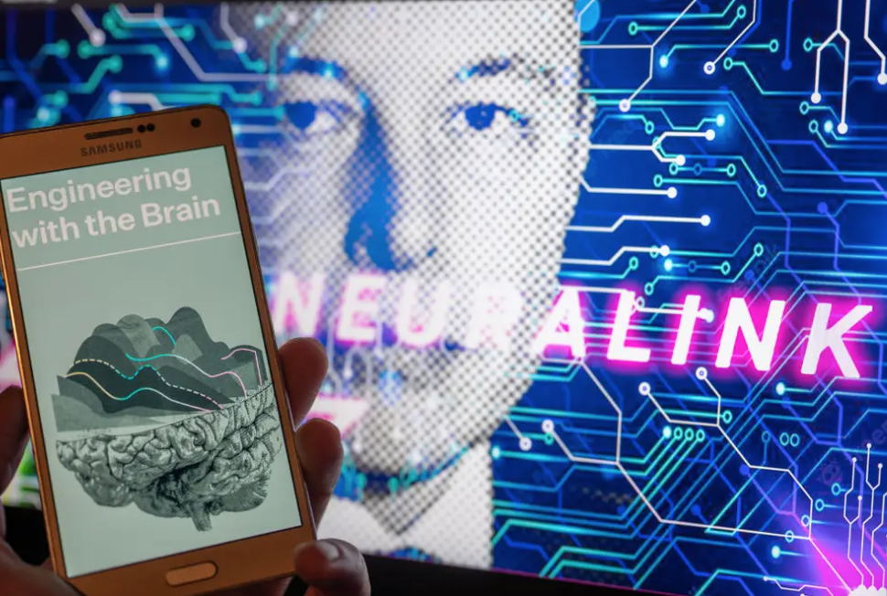 Công ty của Elon Musk thực hiện thành công ca cấy chip vào não cho bệnh nhân đầu tiên